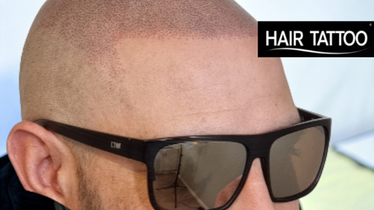 Hair Tattoo for Bald Head: Transform Your Look Today