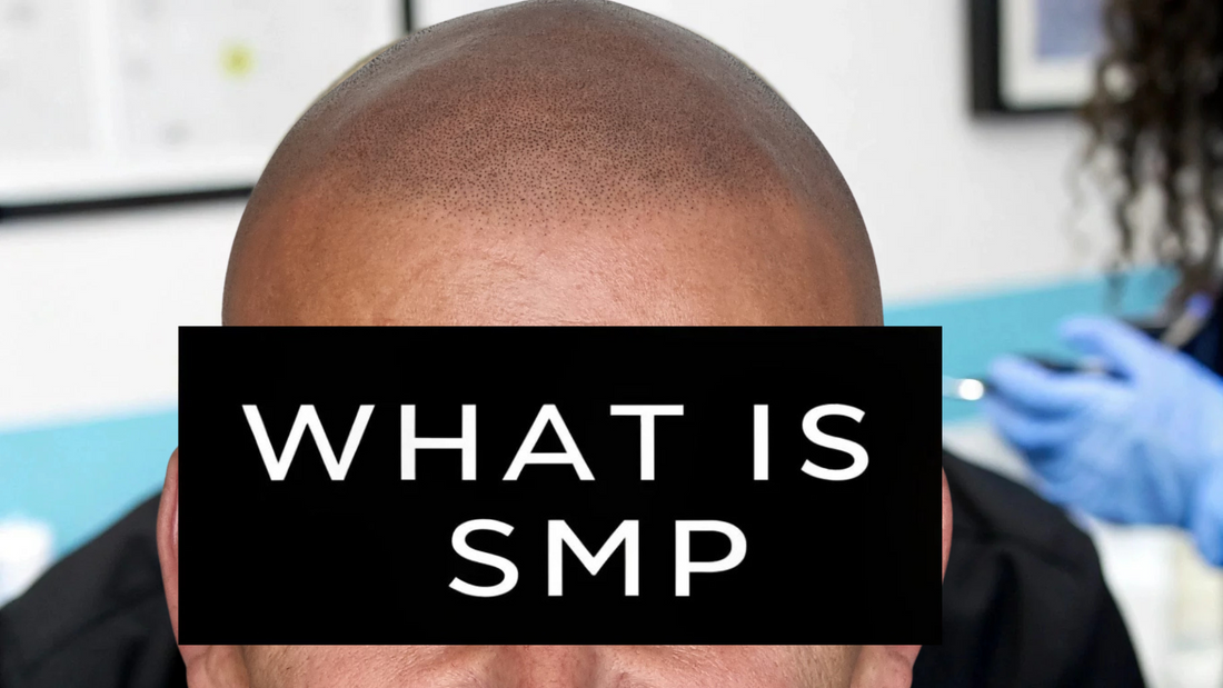 What is Smp, Find out at My Transformation hair tattoo specialist