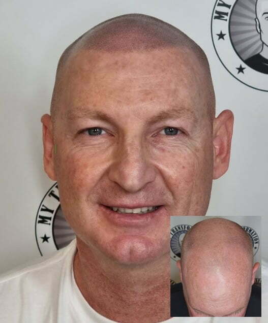 Hair Tattoo  Client Yokine Perth Wa