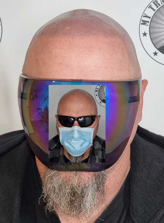 Scalp Micropigmentation Rockingham Perth Wa