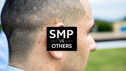 How Does SMP Compare to Other Hair Restoration Methods? Explained