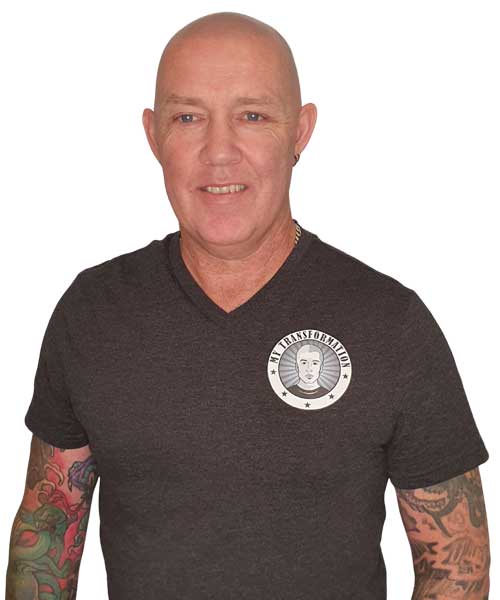 Michael Scalp Micopigmentation Artist & Beard Tattoo