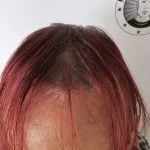 My Transformation, Scalp Micropigmentation Perth, Women's Hair Tattoo Perth, SMP Perth, SMP WA, Perth Australia
