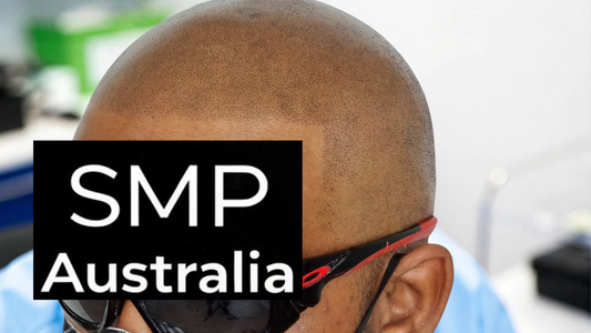 Get Scalp Micropigmentation for Baldness in Perth for UK Visitors on Holiday