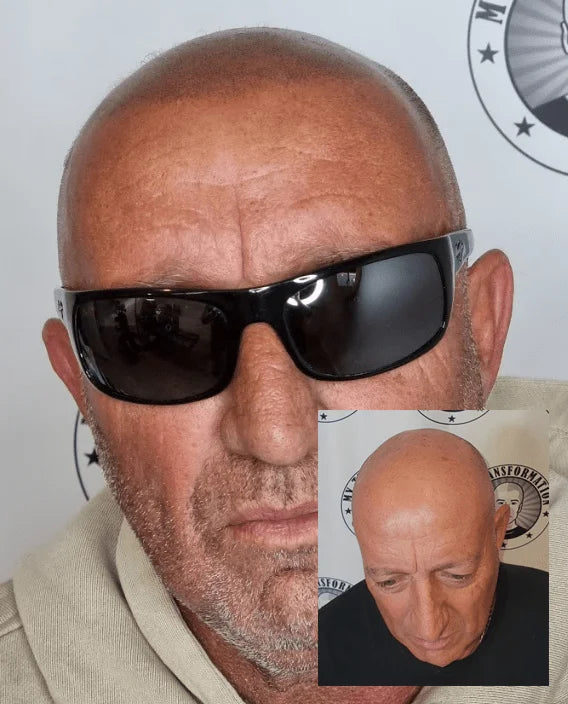 Scalp Micropigmentation Ashby Perth Wa