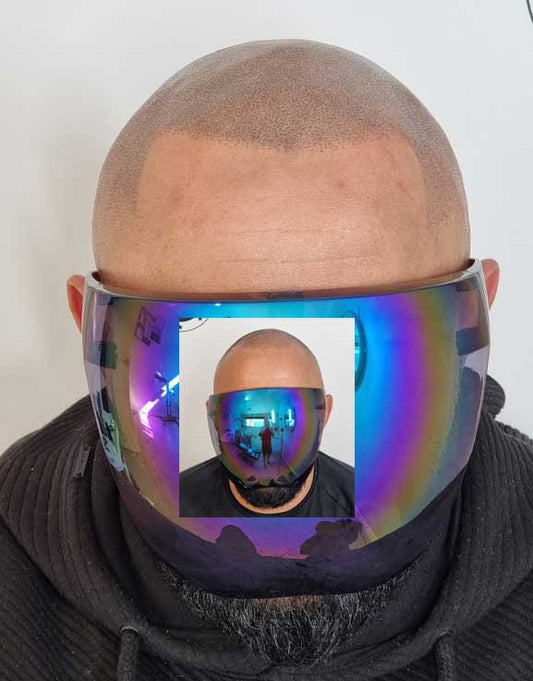 Scalp Micropigmentation Rivervale Perth Wa