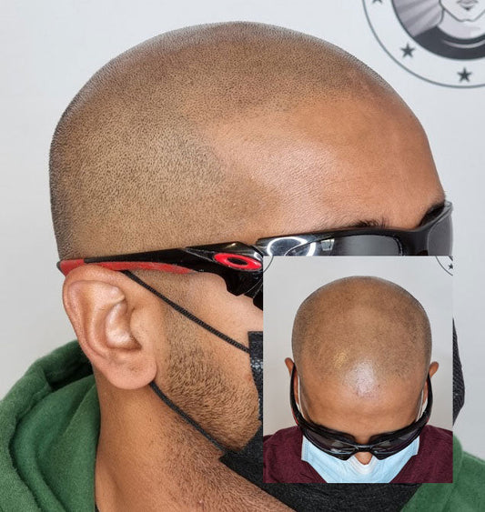 Hair Tattoo for Thinning Hair in Perth