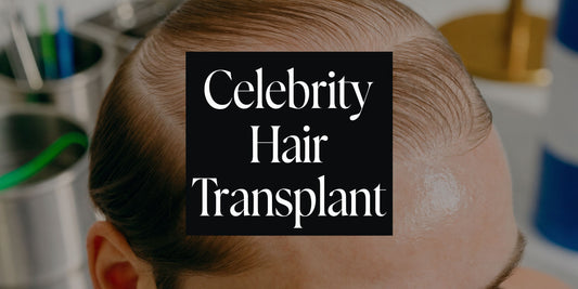 Celebrity Hair Transplant: A Realistic WA Guide 2026