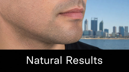 Facial Hair Micropigmentation Perth: Natural Results