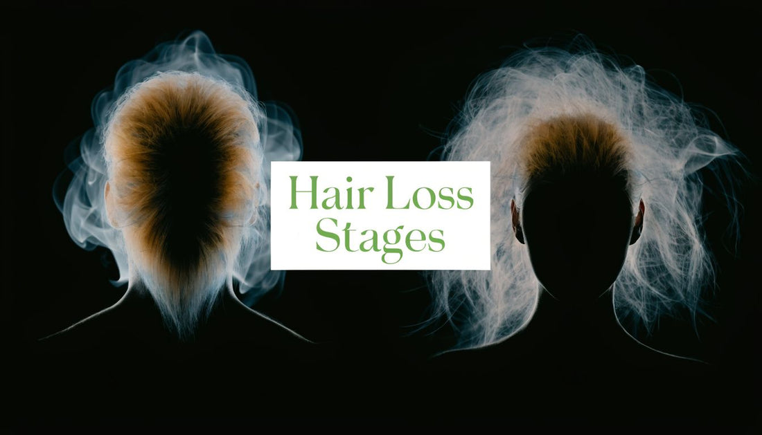 Hair Loss Stages: A Guide for Men & Women in WA
