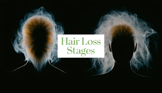 Hair Loss Stages: A Guide for Men & Women in WA