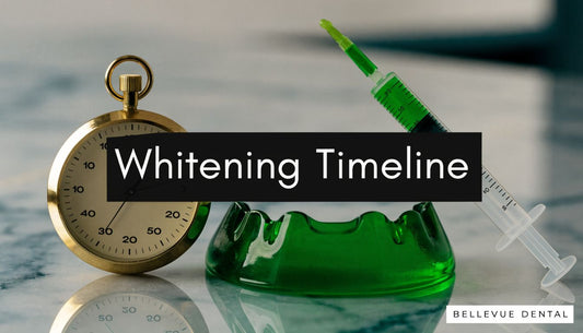 How Long Does Teeth Whitening Take? A Complete Timeline
