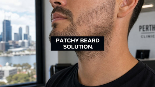 Patchy Beard Solution Perth: Achieve a Fuller Beard in 2026