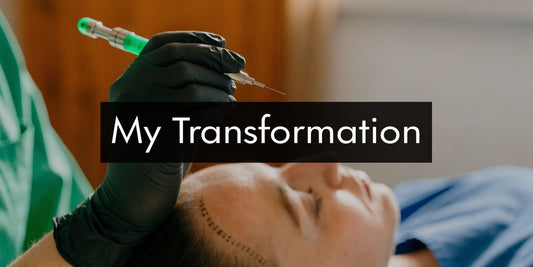 Scalp Micropigmentation Cannington - My Transformation