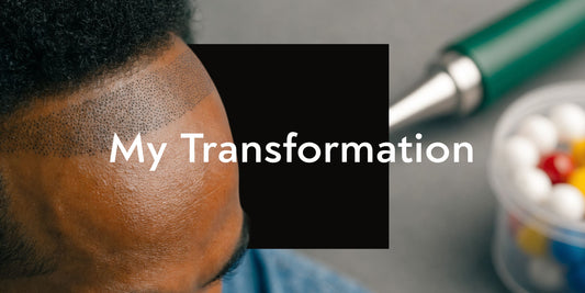 Scalp Micropigmentation Ellenbrook - My Transformation
