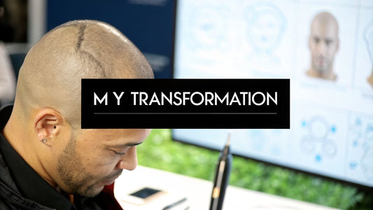 Scalp Micropigmentation Joondalup - My Transformation