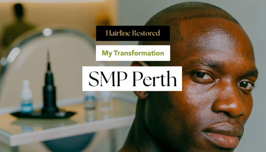 Scalp Micropigmentation Near Me Perth | My Transformation