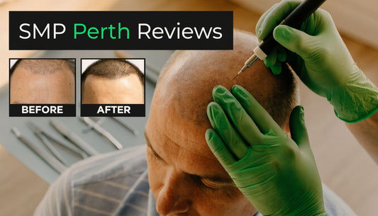 The Top 7 SMP Perth Reviews (2026 Guide)