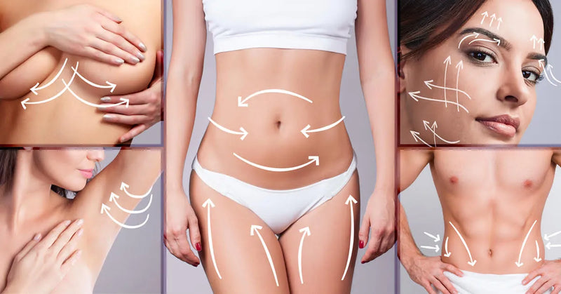 Body Contouring Perth WA - Katie at My Transformation Ballajura