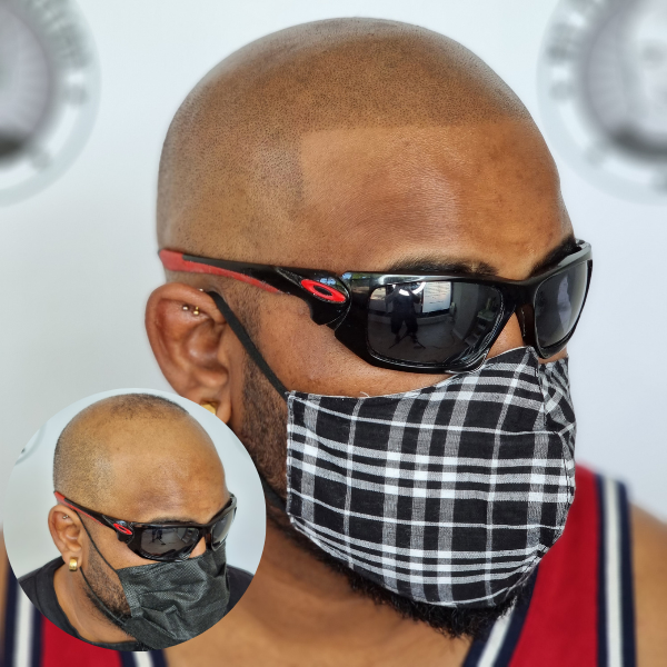 Before SMP - hair loss before scalp micropigmentation model session My Transformation Perth
