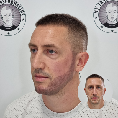 Beard tattoo result Perth