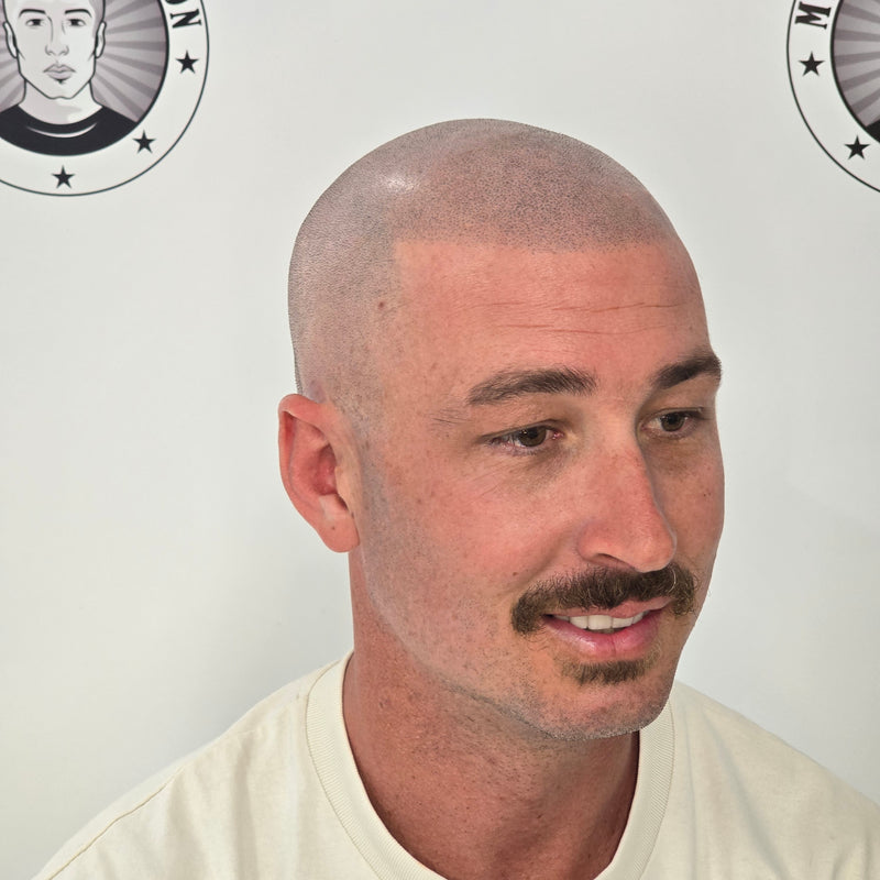 Perth Scalp SMP Scalp Micropigmentation results My Transformation Hair Tattoo Perth SMP in action